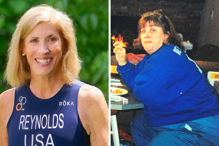 sue reynolds before after